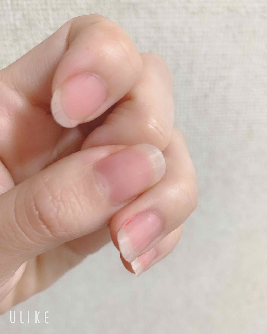 エルファー ネイルキッスB/DAISO/除光液を使ったクチコミ（2枚目）