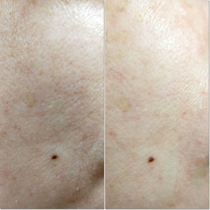 ゼロ毛穴パッド 2.0/MEDICUBE/トナーパッドを使ったクチコミ(5枚目)