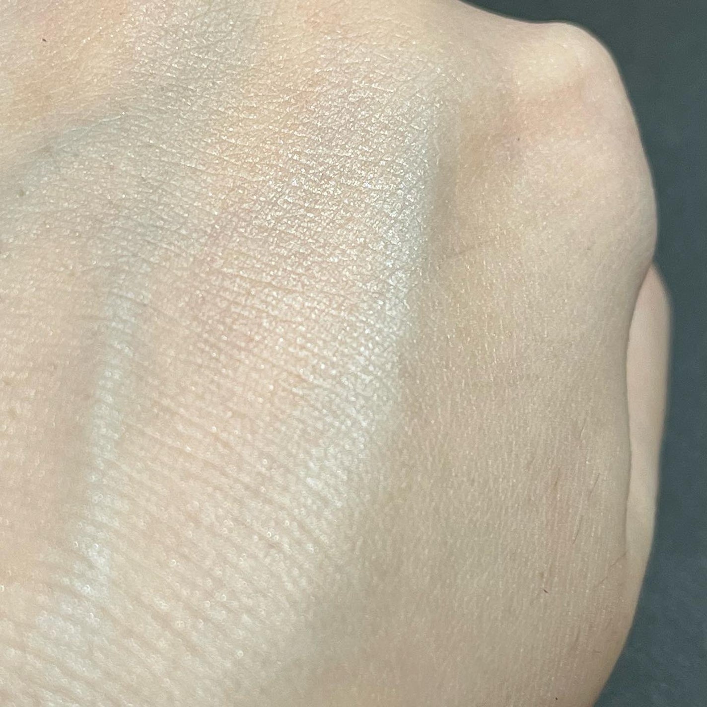 バイオイル/バイオイル/フェイスオイルを使ったクチコミ(4枚目)