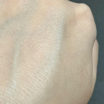 バイオイル/バイオイル/フェイスオイルを使ったクチコミ(4枚目)