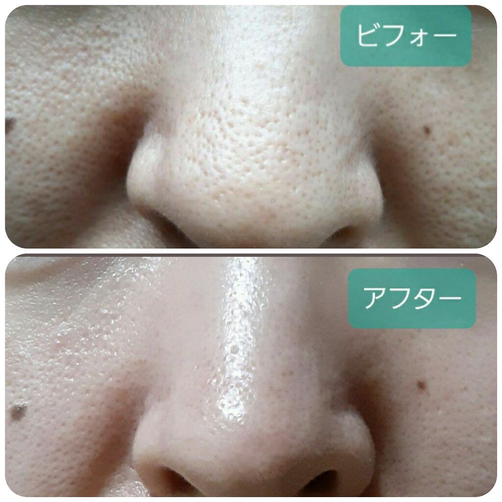 ホホバオイル/無印良品/ボディオイルを使ったクチコミ（3枚目）