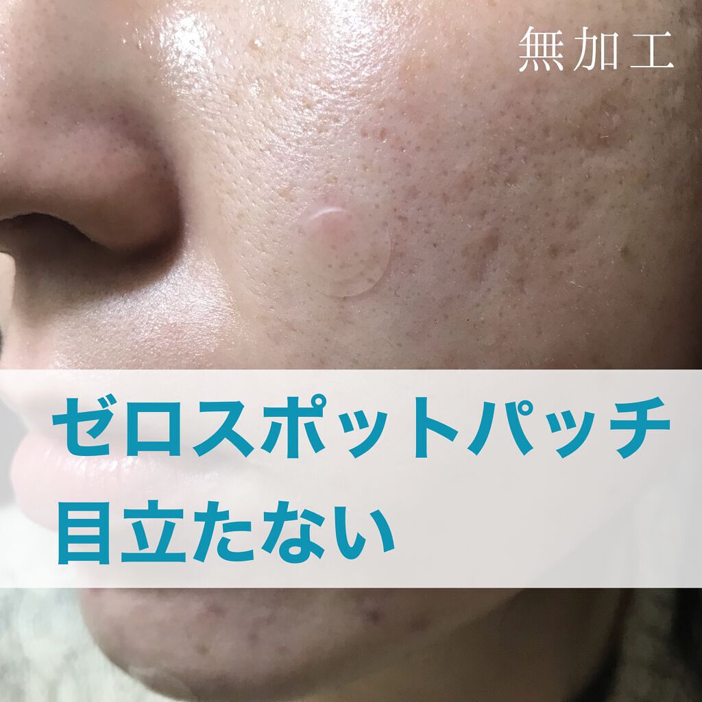 A-zero Shot Trouble Dressing Spot Patch/MEDIHEAL/シートマスク・パックを使ったクチコミ（1枚目）