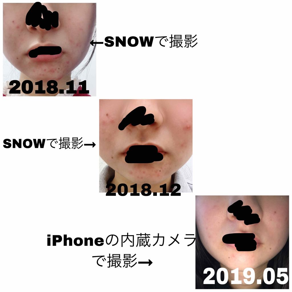 薬用 雪肌精 乳液 エンリッチ/雪肌精/乳液を使ったクチコミ(2枚目)