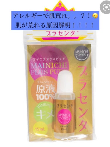 【肌が荒れる原因って、、、？！】

👩🏻肌荒れ原因解明その1😞【プラセンタ編】

今回は私的ですがお肌が荒れる原因が解明してきたのでご紹介していきたいと思ってます。！

私はアレルギー持ちで、豚肉（加工品を含む）、お米、卵、ハウスダスト、スギ花粉、ヒノキ花粉、寒暖差、日光（紫外線含む）などあります。。🥲

プラセンタってご存知でしょうか。？
プラセンタの成分で豚肉を含むや植物性プラセンタ、馬などさまざまあるのですが、豚肉の成分はもちろんなんですが、プラセンタそのものが合わなくて今まで何も調べずに使って肌荒れして、、の繰り返しをしていました。、、

プラセンタはすごいいい機能があって、美肌や、ハリ、美白などあるのですが、私にはダメでした。

化粧水でプラセンタ成分が入った物を知らず知らずに使っていてなんか調子悪いなあって方がいましたら、アレルギー検査やプラセンタを含んでいない化粧水を買ってみて切り替えてみてはいかがでしょうか？？

人それぞれお肌が荒れる原因は違いますが、参考になれば、、と思ってます☺️


#mediheal #プラセンタ リバイタルエッセンシャルマスクEX #発酵プラセンタ #ホワイトラベル #プラセンタ #アレルギー #肌荒れ の画像 その0