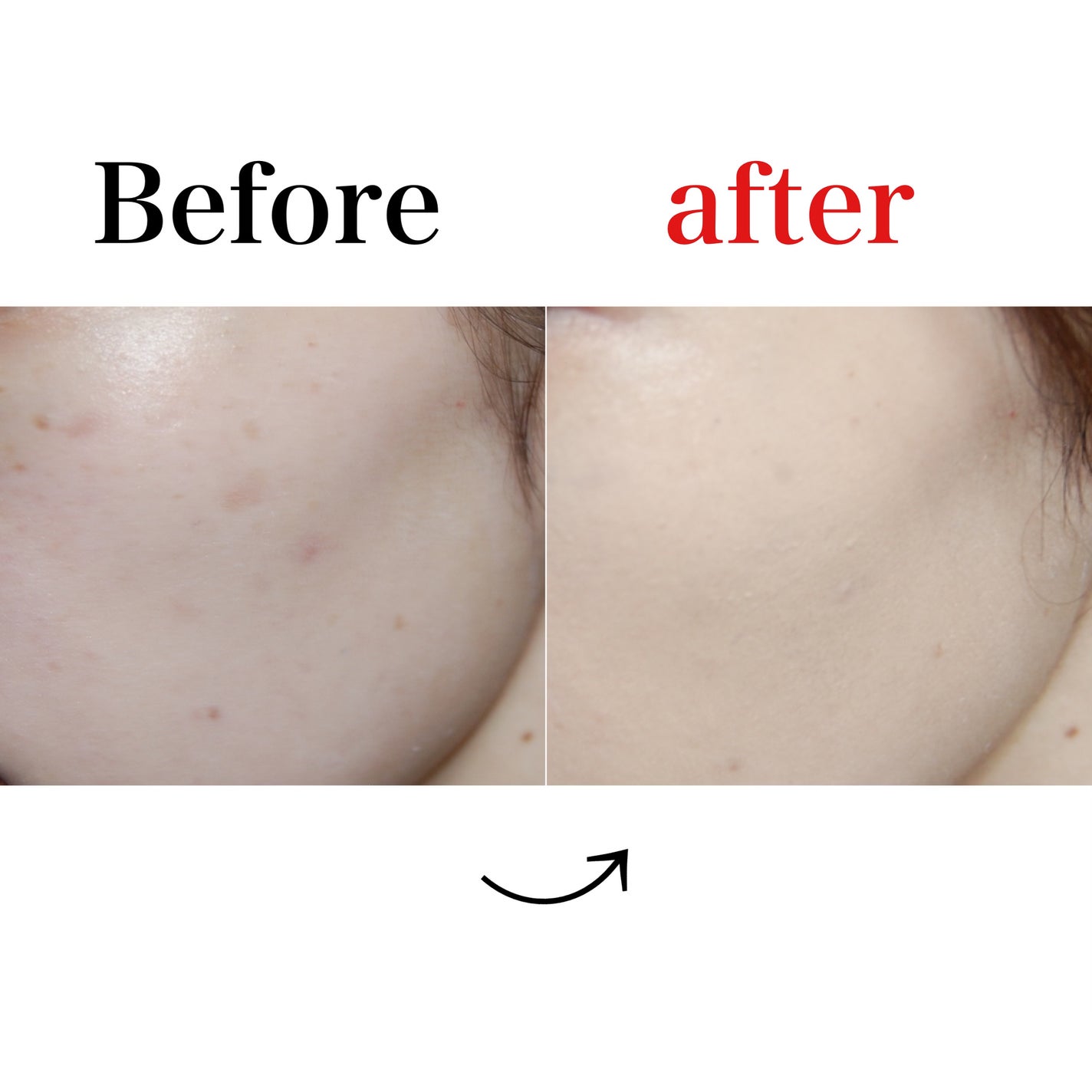 インウイ リキッドファンデーション/INOUI/リキッドファンデーションを使ったクチコミ(5枚目)