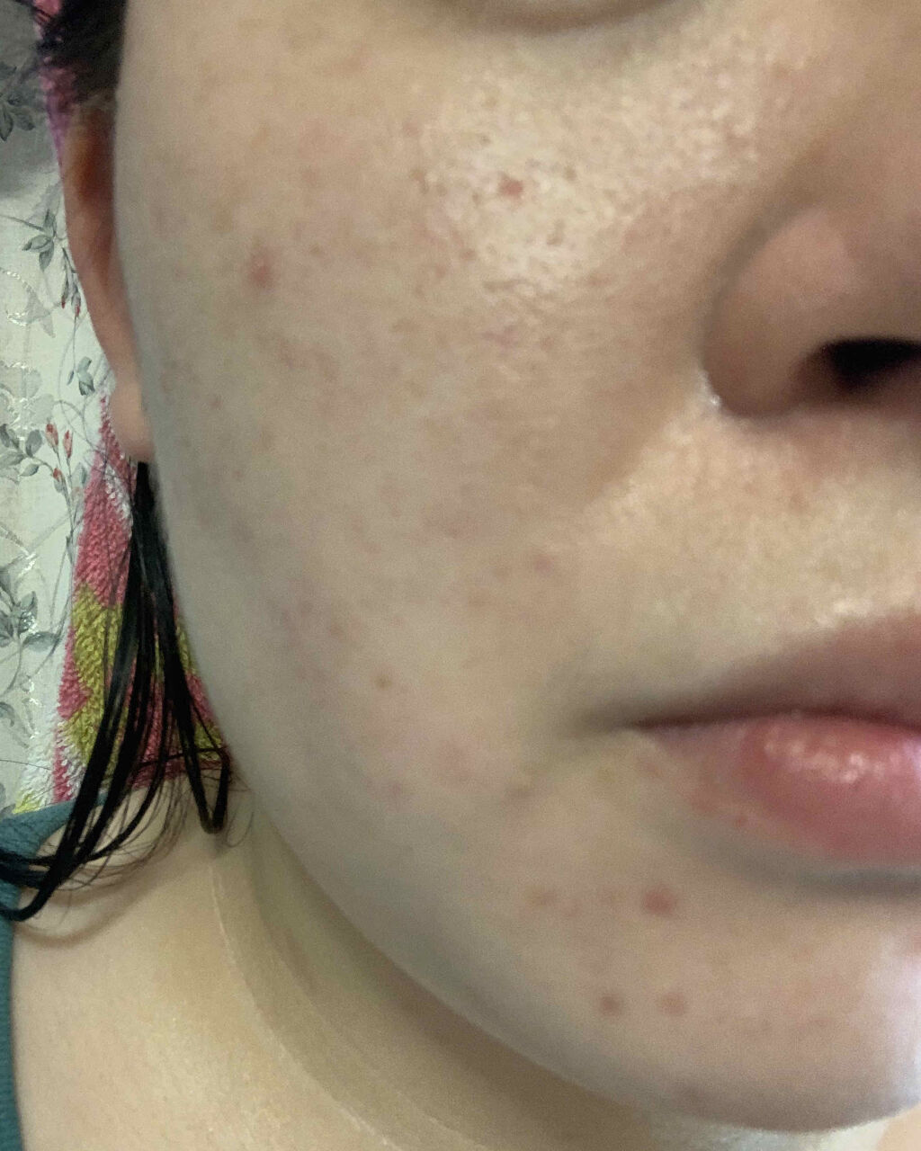 リペアエッセンスクリーム/ツボクサレディ/フェイスクリームを使ったクチコミ（2枚目）