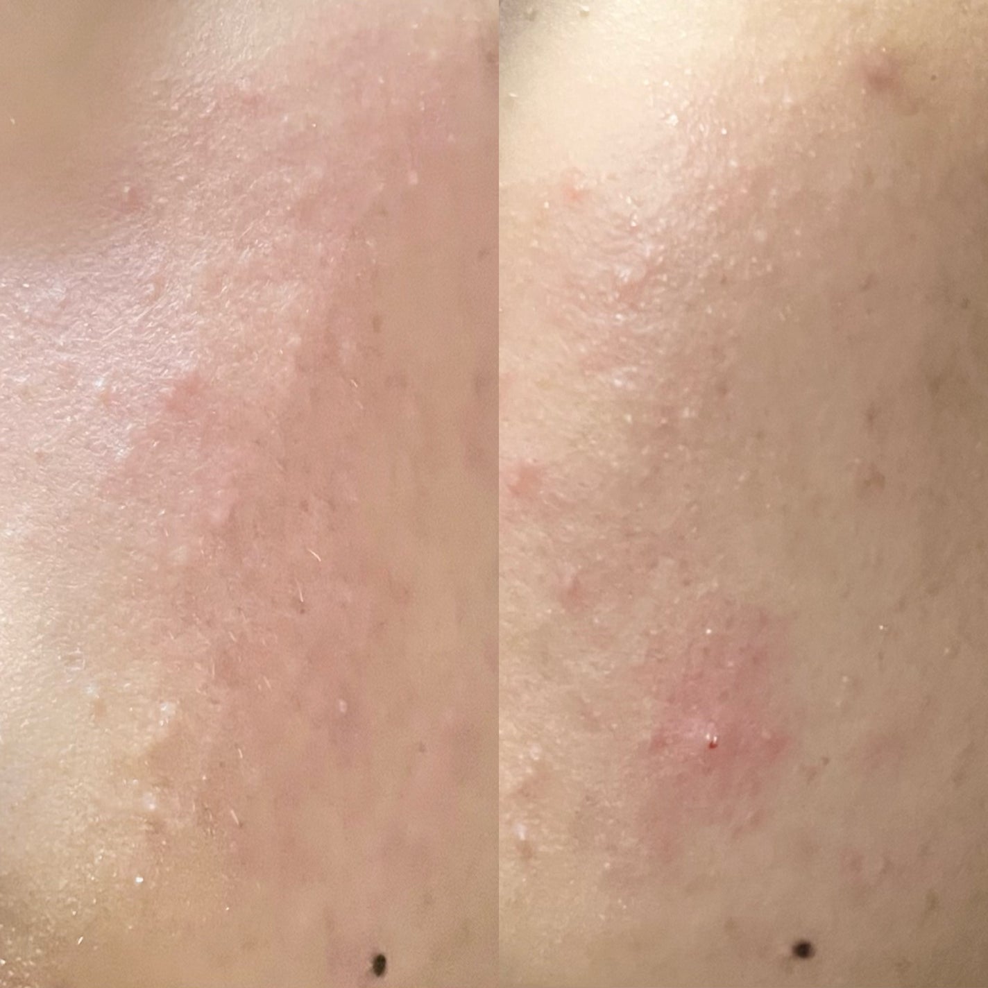 スーパーヴォルカニック ポア クレイマスク/innisfree/洗い流すパック・マスクを使ったクチコミ(7枚目)