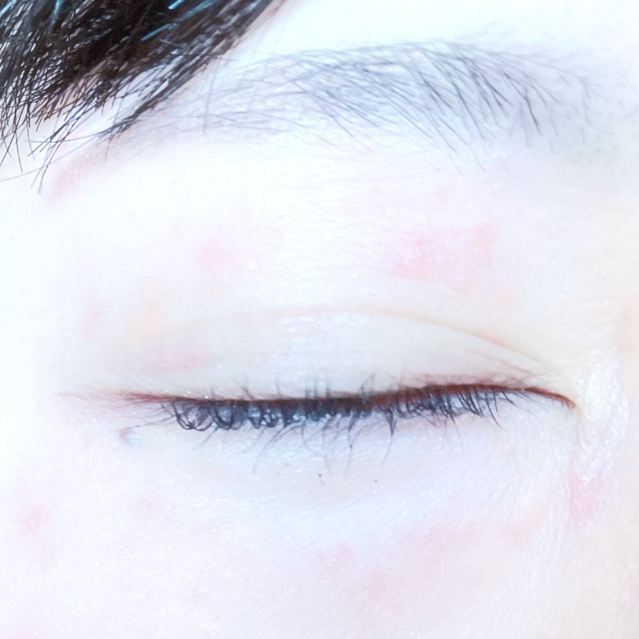 抗菌アイリスα(医薬品)/大正製薬/その他を使ったクチコミ(4枚目)