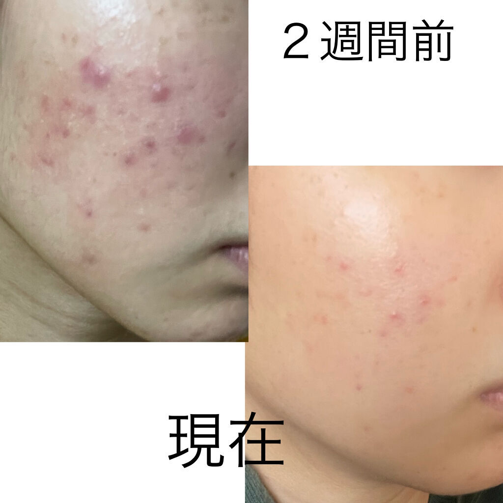 サミュ PHセンシティブクリーム/SAM'U/フェイスクリームを使ったクチコミ（1枚目）