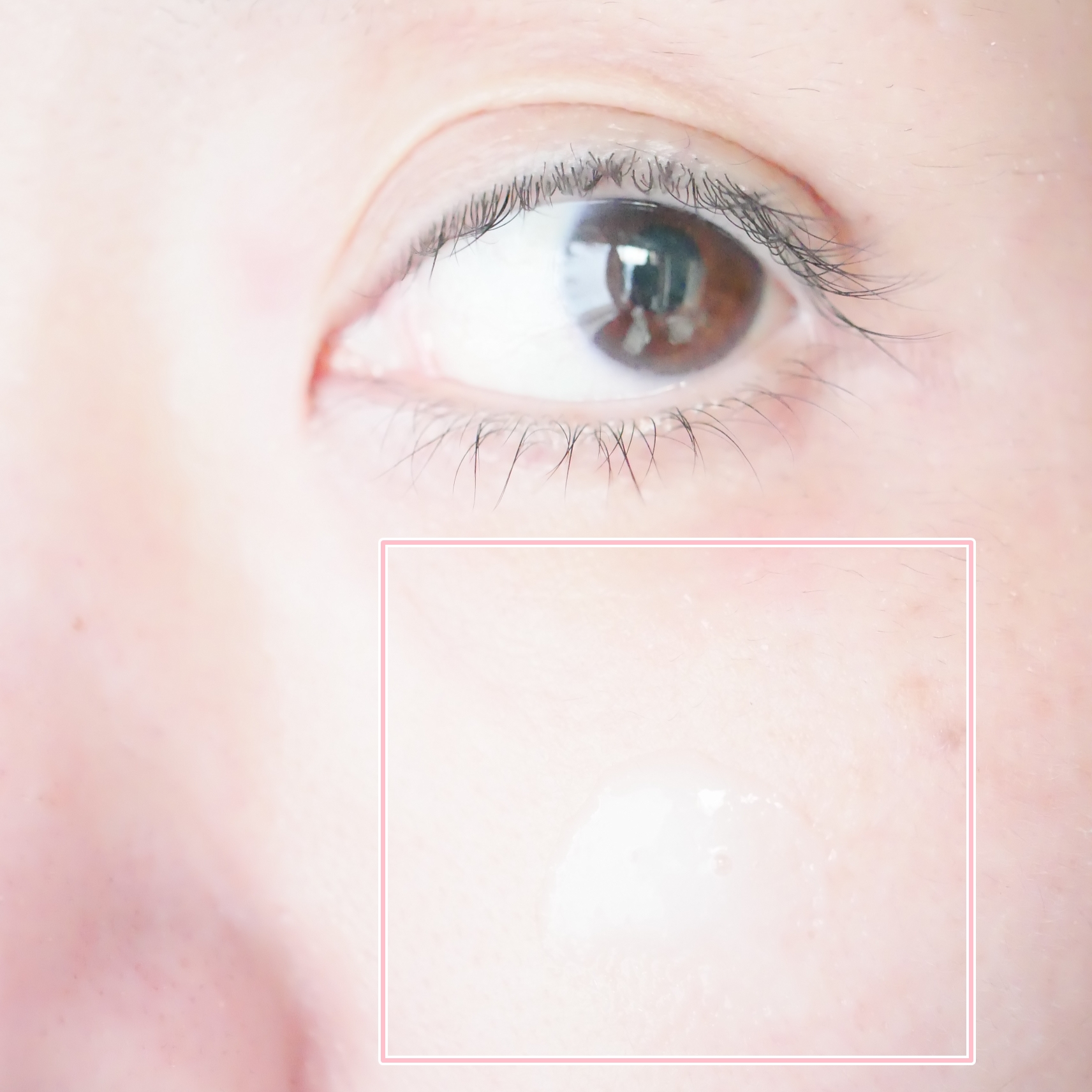 プロバイオシカ インテンシブ アンプル/SKIN1004/美容液を使ったクチコミ（3枚目）