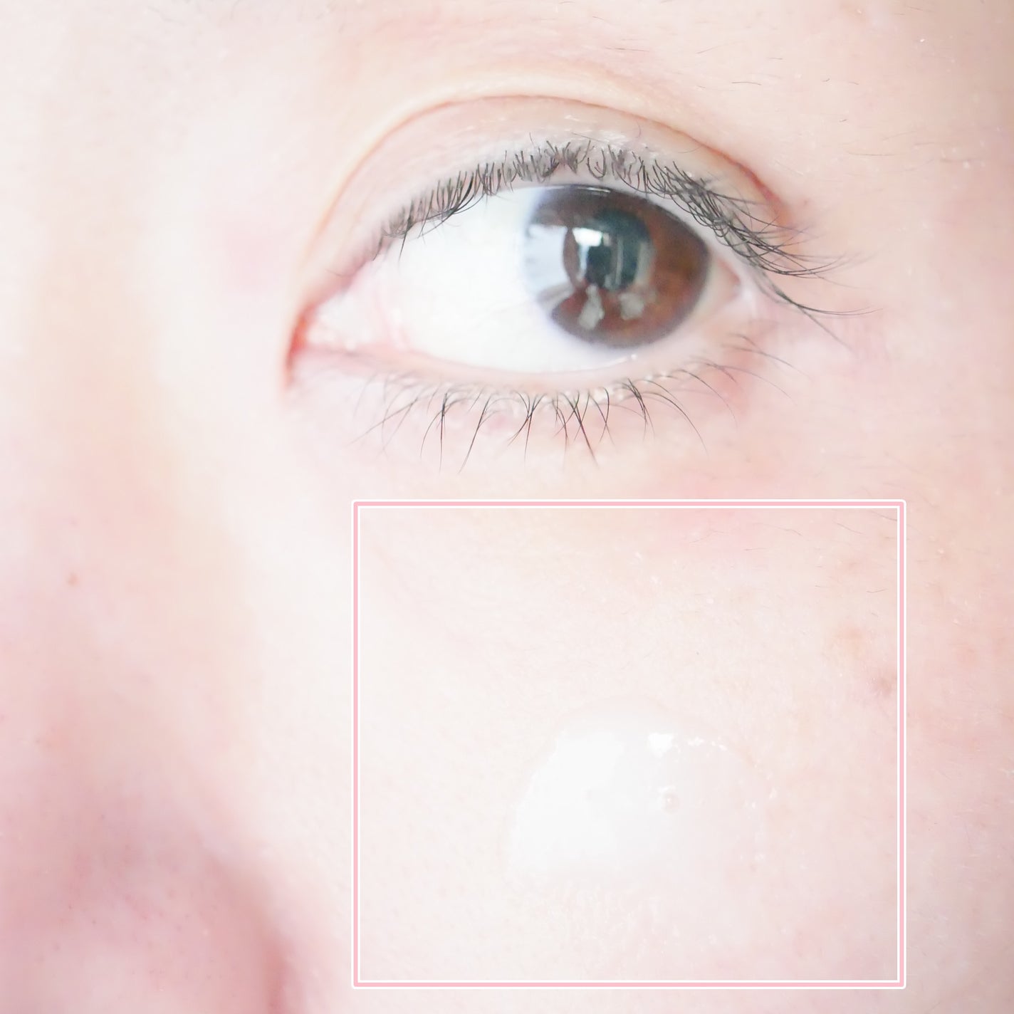 プロバイオシカ インテンシブ アンプル/SKIN1004/美容液を使ったクチコミ(3枚目)