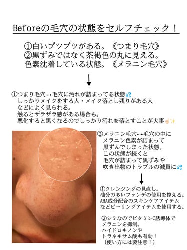 イハダ 薬用バーム【医薬部外品】/IHADA/フェイスバームを使ったクチコミ（2枚目）