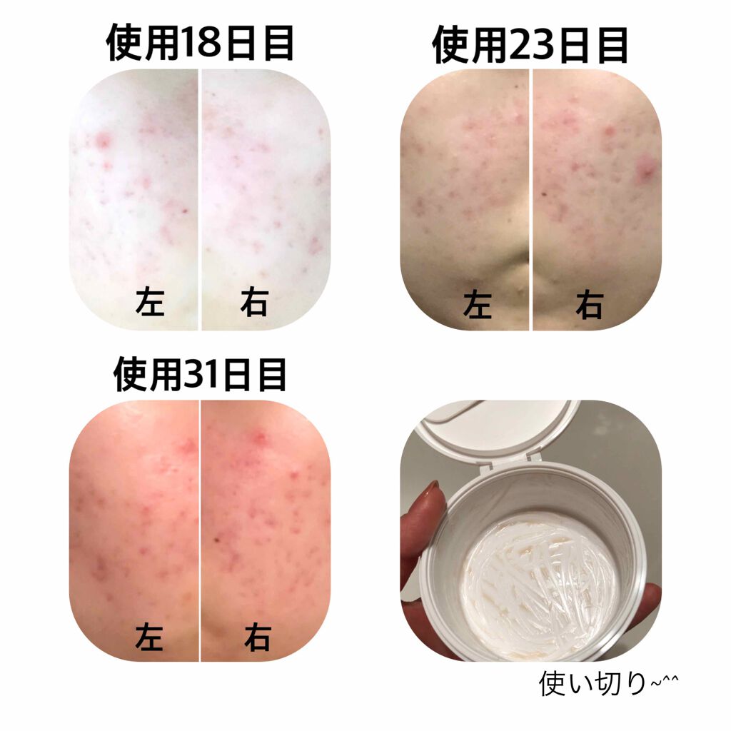 デュオ ザ クレンジングバーム ホワイトa/DUO/クレンジングバームを使ったクチコミ（3枚目）