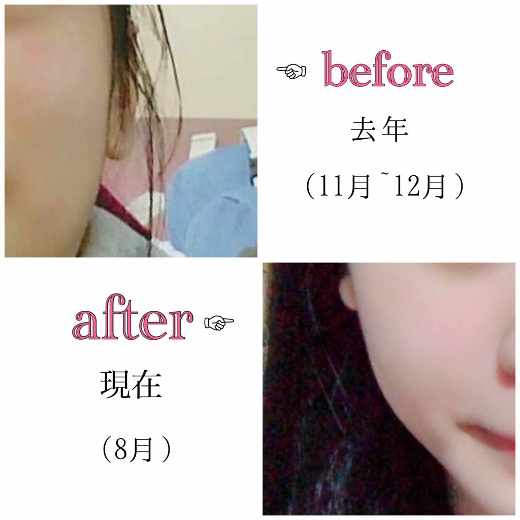 ハトムギ洗顔/プライムビューティー/洗顔フォームを使ったクチコミ（2枚目）