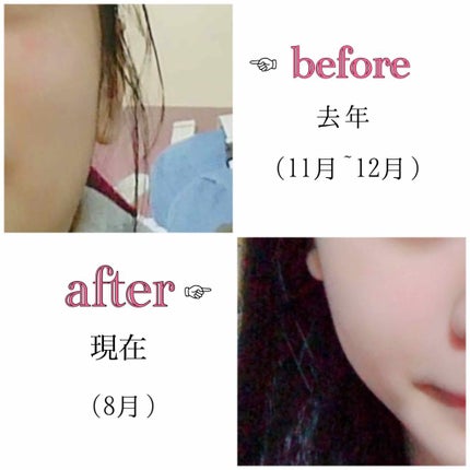 ハトムギ化粧水(ナチュリエ スキンコンディショナー R )/ナチュリエ/化粧水を使ったクチコミ(2枚目)