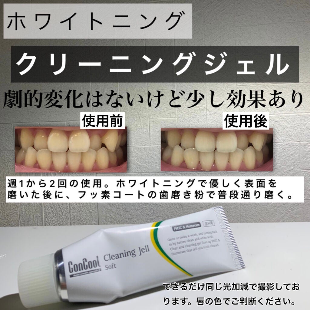 ジェルコートF/ウエルテック/その他オーラルケアを使ったクチコミ(3枚目)