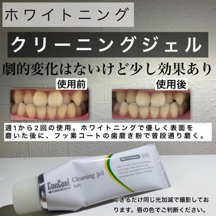 ジェルコートF/ウエルテック/その他オーラルケアを使ったクチコミ(3枚目)