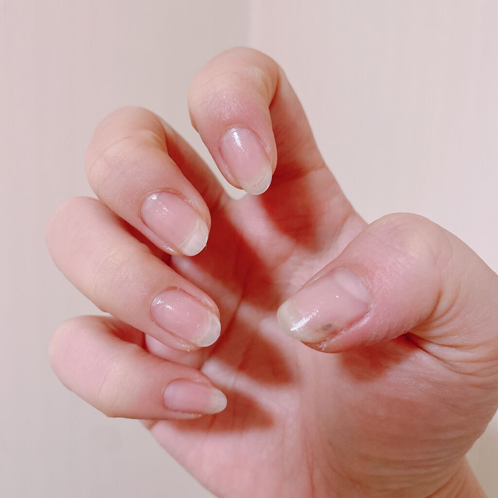 トリプルファイバーラップ/ネイリスト/ネイルベースコートを使ったクチコミ(5枚目)