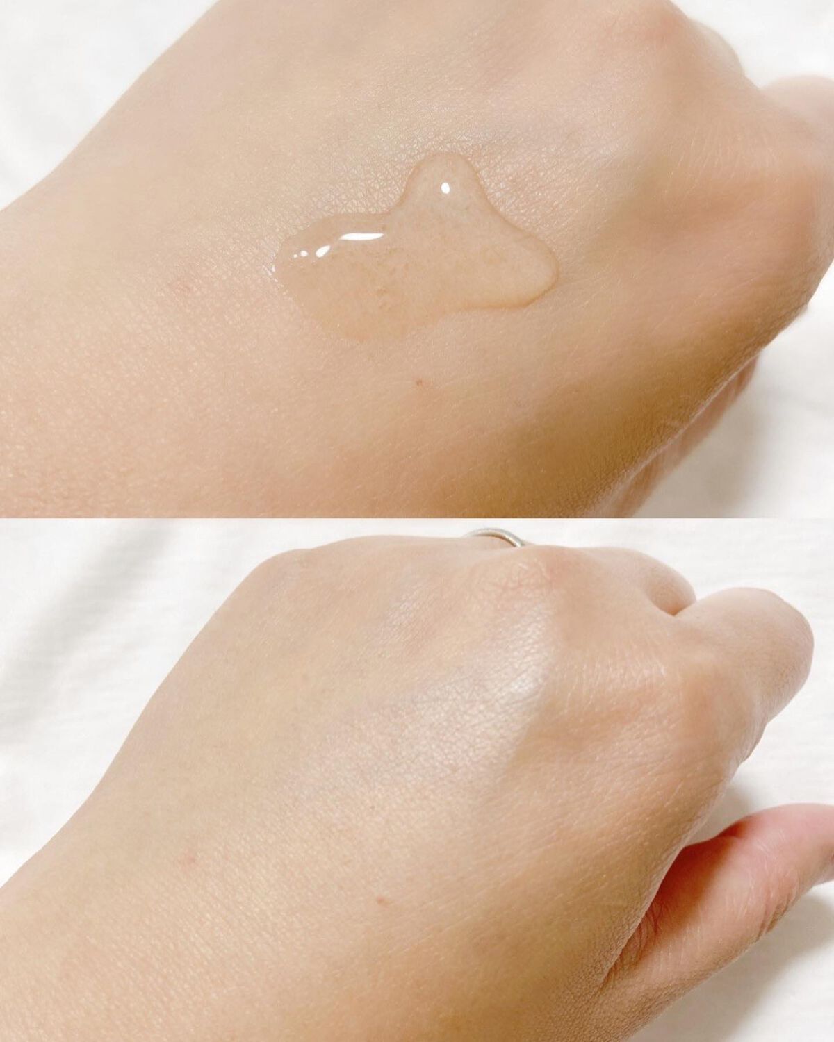 リムヴェール LSピュア/リムサプライ/美容液を使ったクチコミ(4枚目)