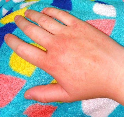 薬用ハンド&フィンガー/ヴァセリン/ハンドクリームを使ったクチコミ(4枚目)