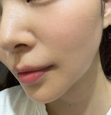 EX VCセラムマスク/EXO LABO/シートマスク・パックを使ったクチコミ(6枚目)