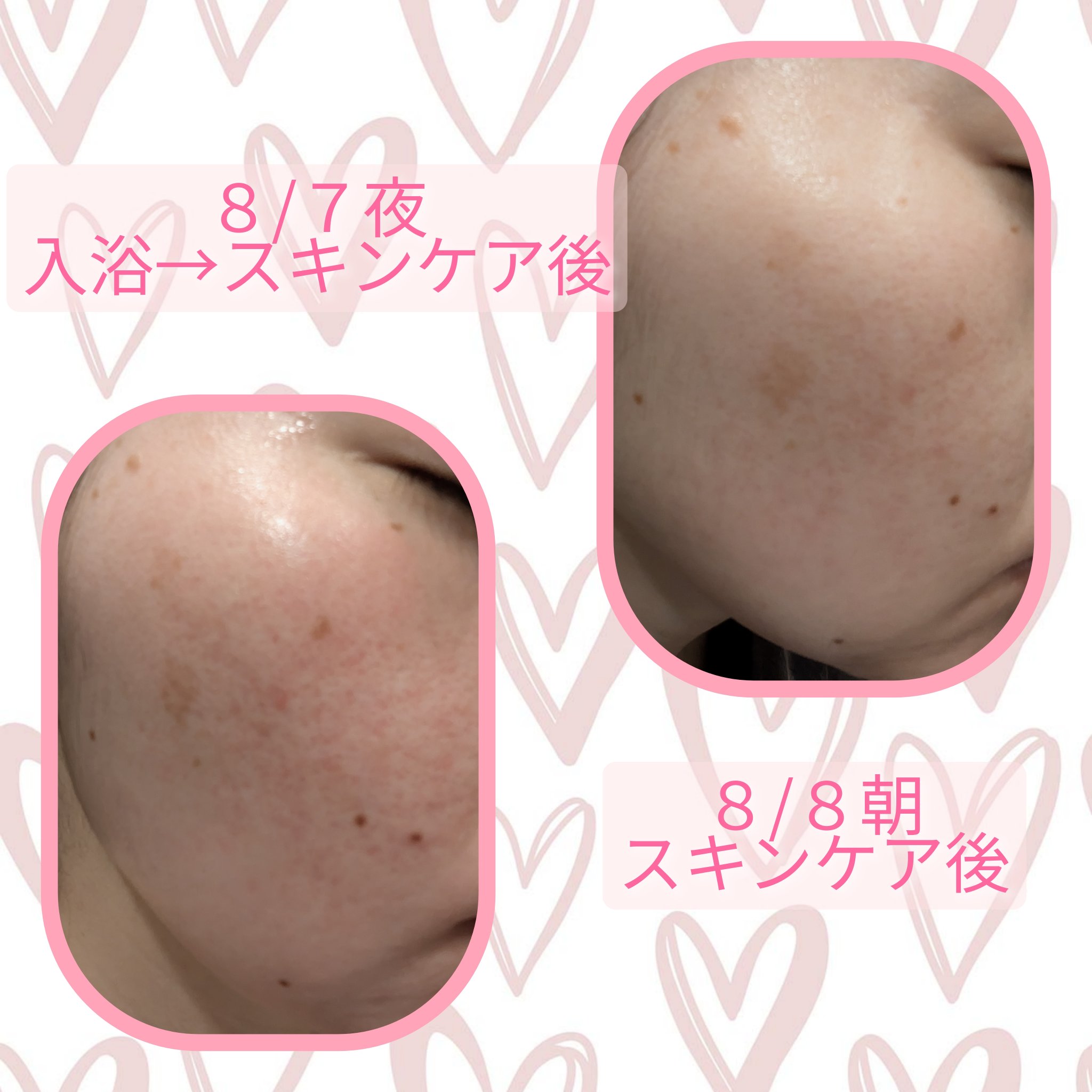 アミノウォッシングフォーム/KISO/化粧水を使ったクチコミ（2枚目）