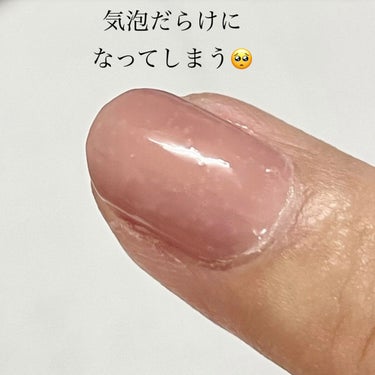 【シュガードール スピーディ トップコートR】
ネイルカラーの上から塗ってジェルネイル風に仕上げるトップコート💅
速乾性で厚みは出てくれますが、塗り方が難しい。
何度やっても10本の爪の何枚かは、画像のような小さな気泡が出来てしまいます。
せっかくキレイにネイルカラーが塗れても気泡でやり直しは疲れちゃうので、リピはなしかな…。

#シュガードール #ネイルケア #ネイル
#トップコート #ジェルネイル #マニキュア #正直レポ の画像 その2