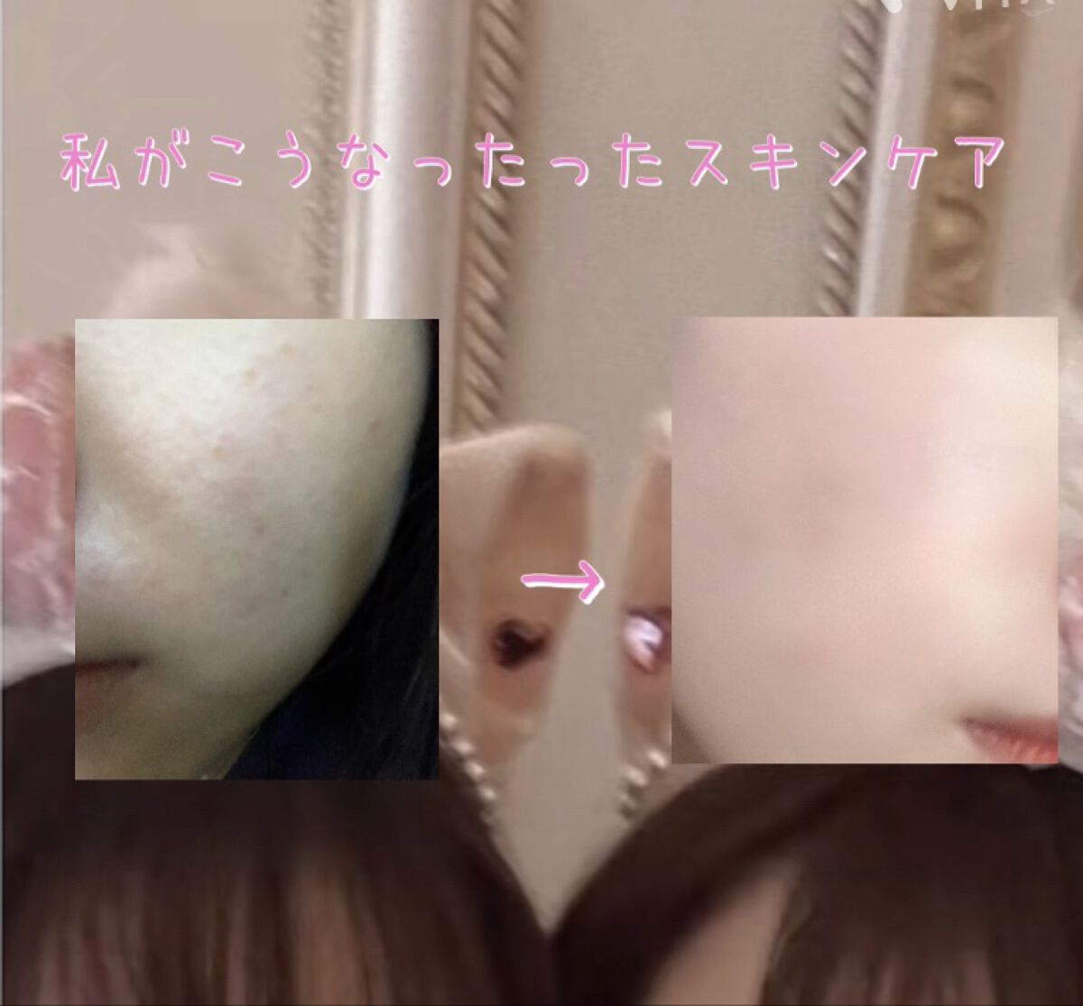 CICA カプセルマスク/VT/洗い流すパック・マスクを使ったクチコミ（1枚目）