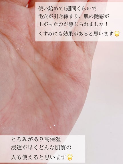 VC100エッセンスローション EX/ドクターシーラボⓇ/化粧水を使ったクチコミ(4枚目)