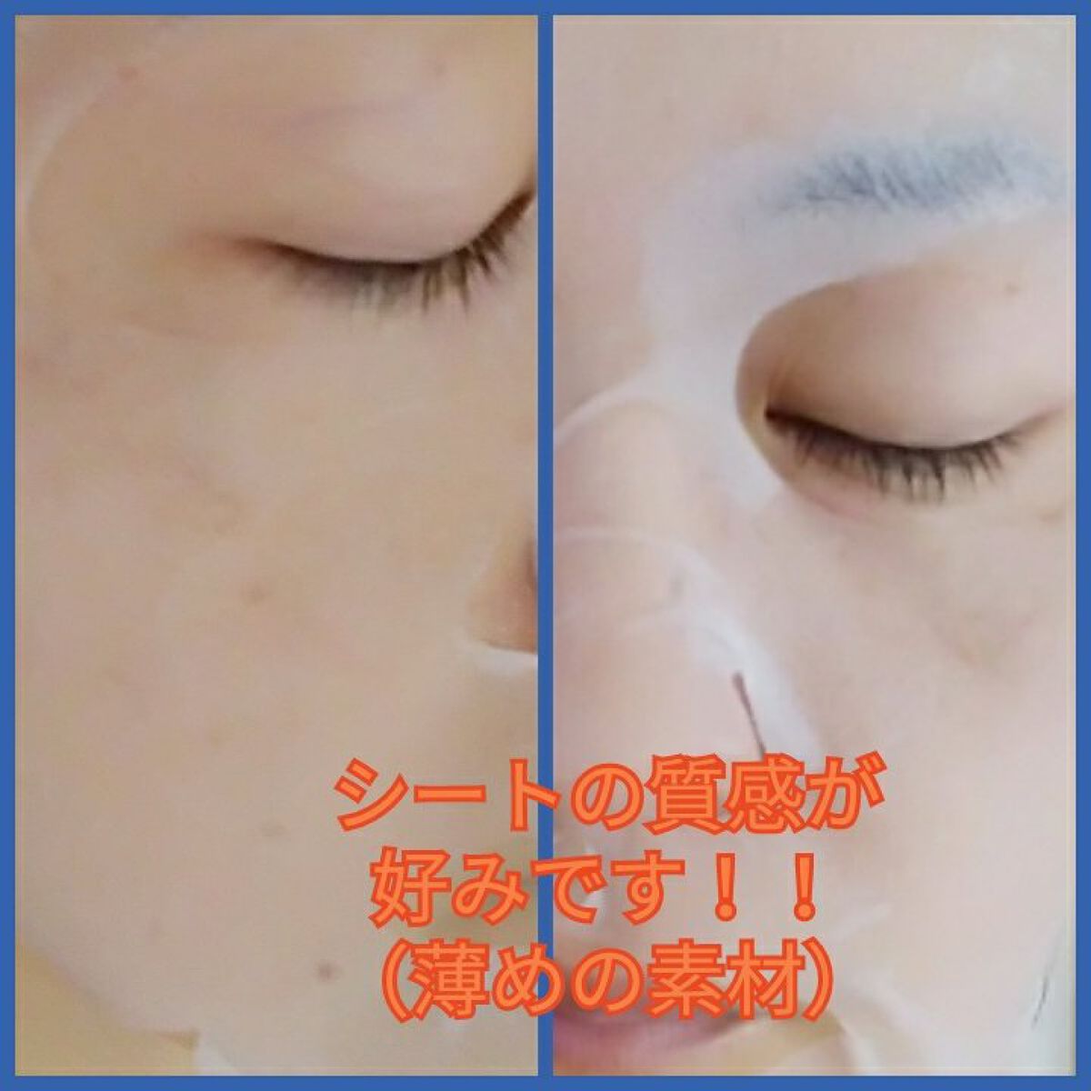 スキントラブルケア マスク/アルージェ/シートマスク・パックを使ったクチコミ（1枚目）