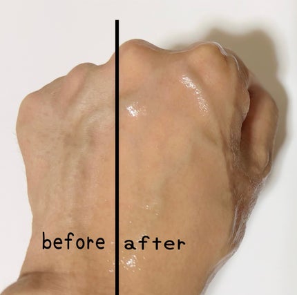 ドクダミセラム/ONE THING/美容液を使ったクチコミ(4枚目)