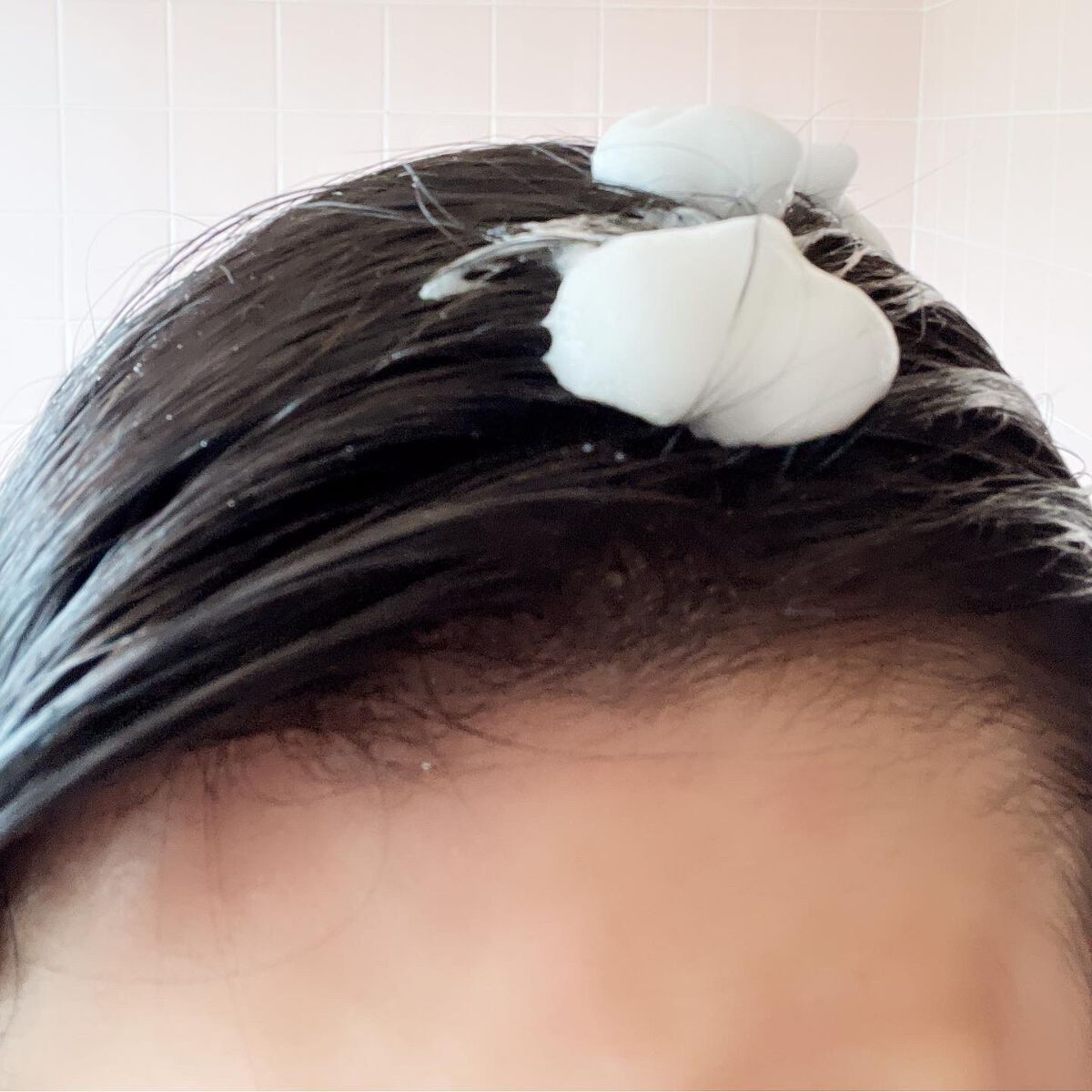 メディケイテッドスカルプフォーム/GROW LAB/頭皮ローションを使ったクチコミ（3枚目）