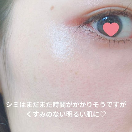 メラノフォーカスZ/HAKU/美容液を使ったクチコミ(3枚目)