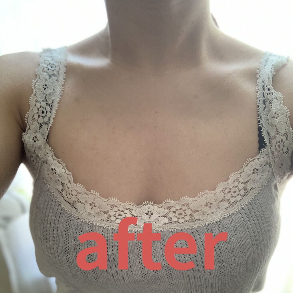 セナキュア(医薬品)/小林製薬/その他を使ったクチコミ（2枚目）