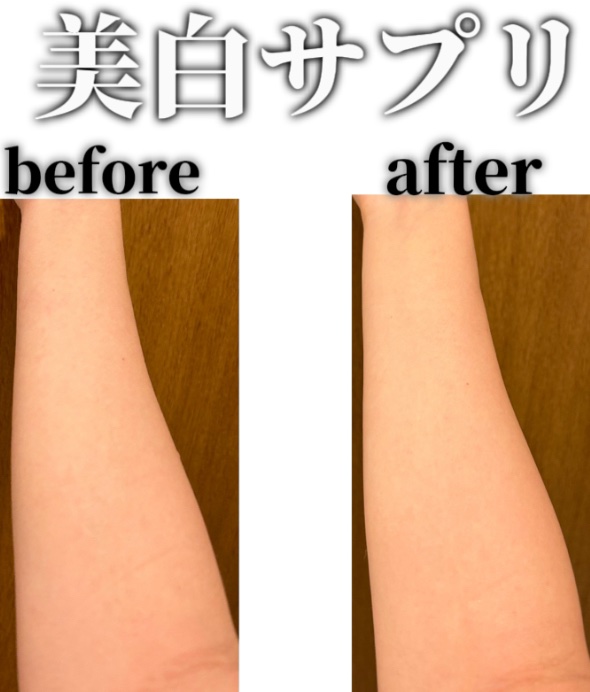 ビタミンC「タケダ」（医薬品）/タケダ/その他を使ったクチコミ（2枚目）