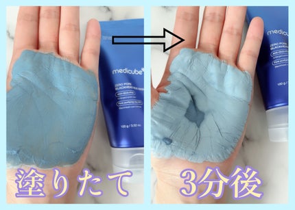 ゼロ毛穴クレイパック/MEDICUBE/洗い流すパック・マスクを使ったクチコミ(4枚目)