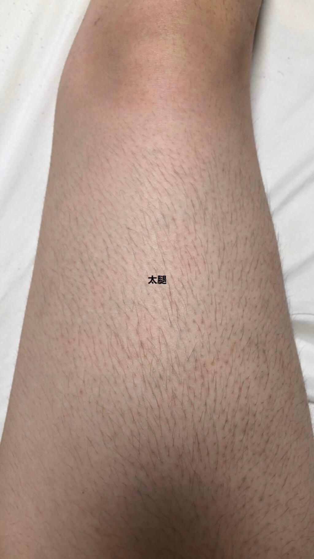 剛毛女 on LIPS 「⚠︎⚠︎⚠︎閲覧注意⚠︎⚠︎⚠︎すっごーーーーーく汚い写真です..」(6枚目)