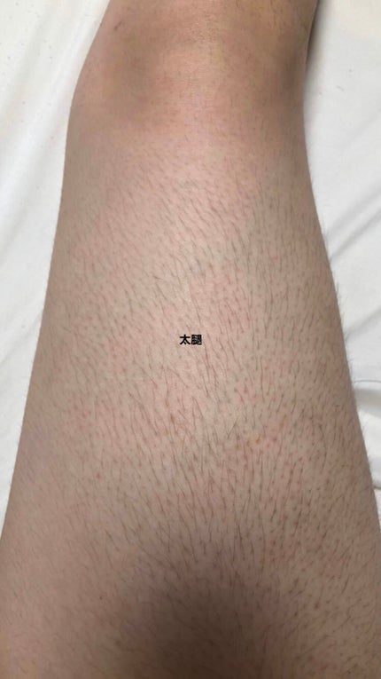 剛毛女 on LIPS 「⚠︎⚠︎⚠︎閲覧注意⚠︎⚠︎⚠︎すっごーーーーーく汚い写真です..」(6枚目)