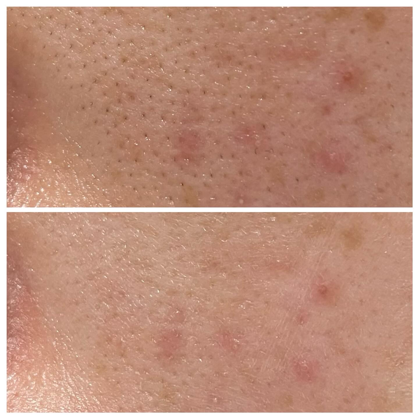 メイクアップベース フェイスレスポンサー/ブリリアージュ/化粧下地を使ったクチコミ（2枚目）