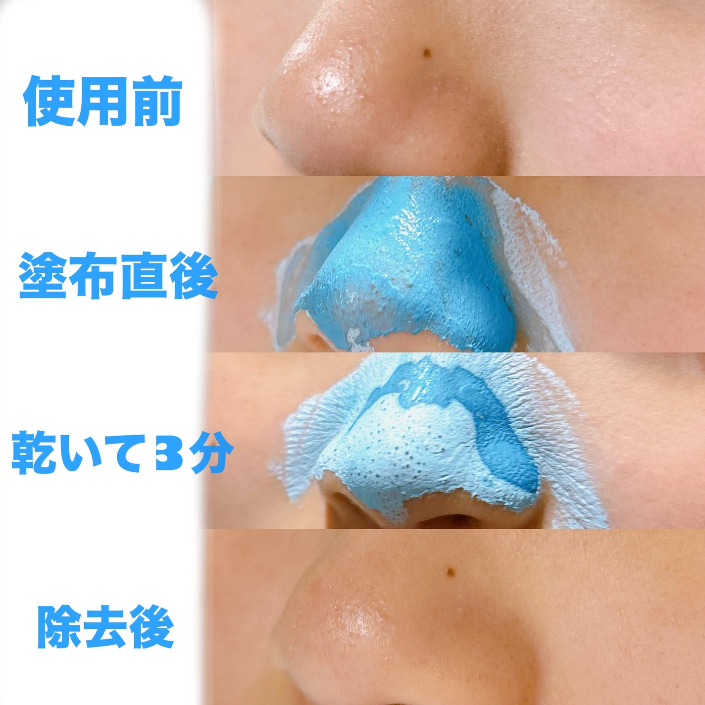 ゼロ毛穴クレイパック/MEDICUBE/洗い流すパック・マスクを使ったクチコミ(2枚目)