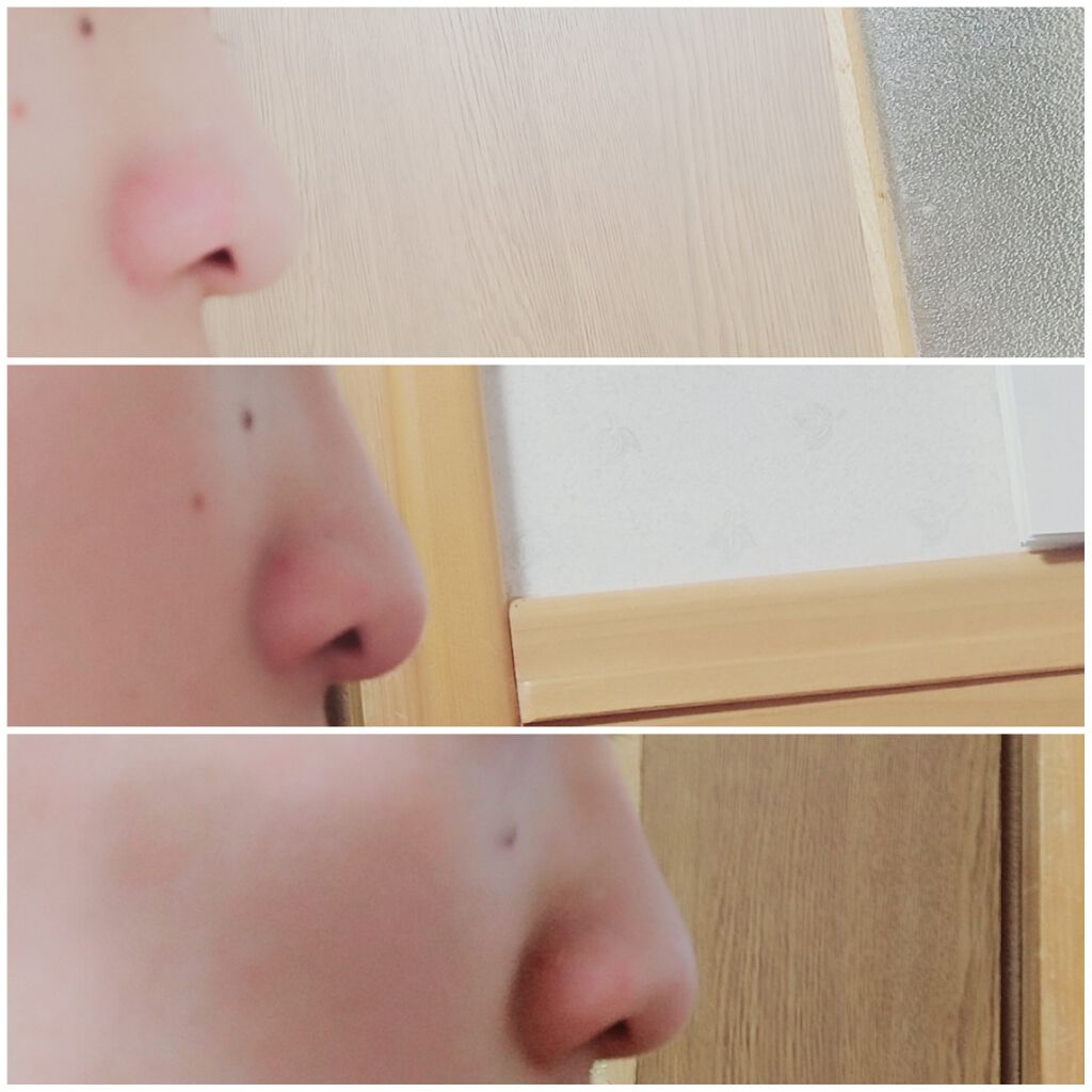 ノーズトレーナー/DAISO/その他スキンケアグッズを使ったクチコミ(2枚目)