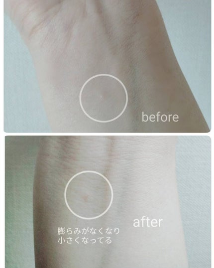 イポケアEX ジェルパッチ/ブレーンコスモス/その他スキンケアを使ったクチコミ(5枚目)