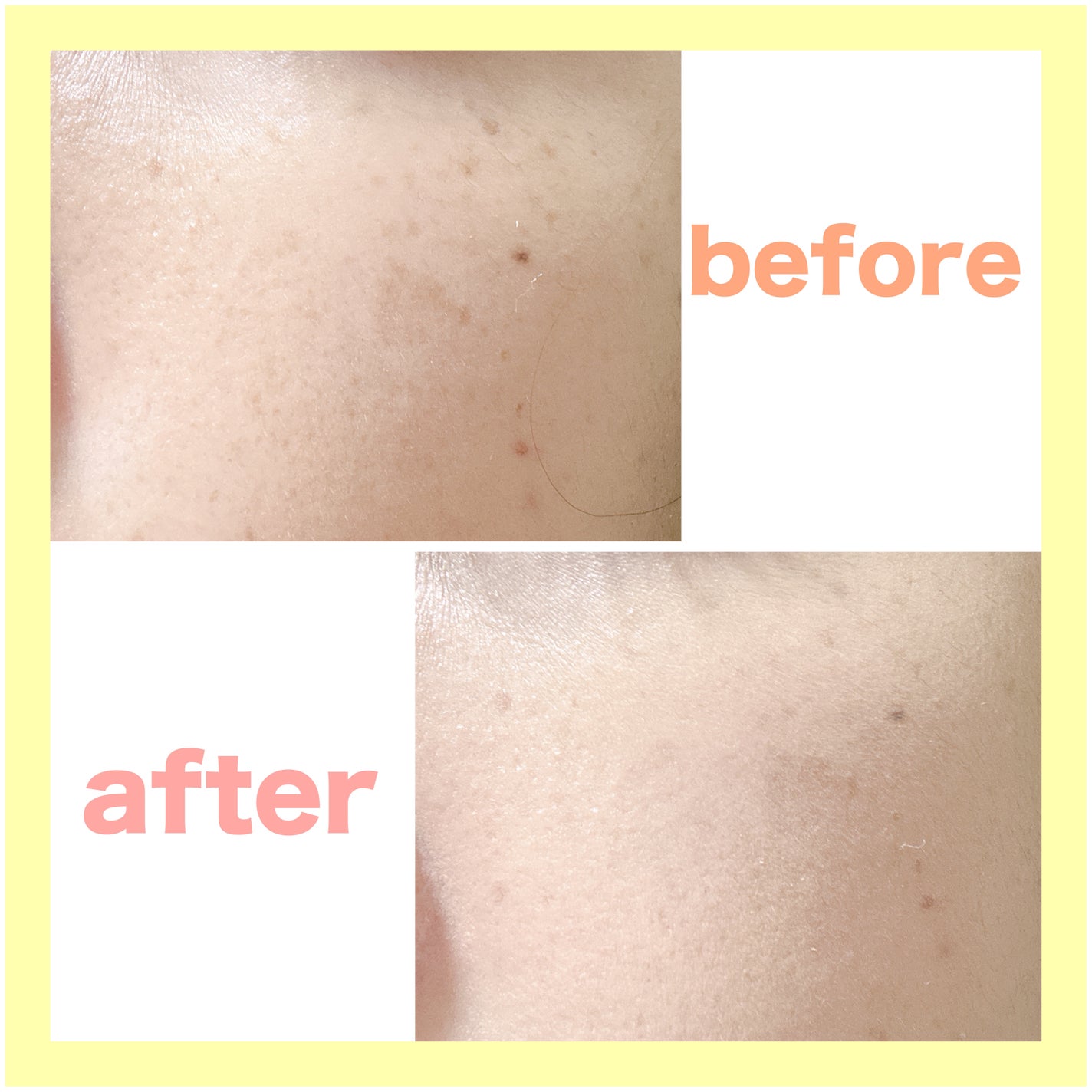 リアル フローレス ウェイトレス パーフェクティング コンシーラー/ローラ メルシエ/リキッドコンシーラーを使ったクチコミ(2枚目)