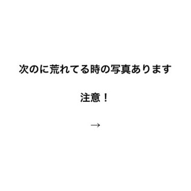 アイビューティー フィクサー WP/アストレア ヴィルゴ/二重まぶた用アイテムを使ったクチコミ（2枚目）