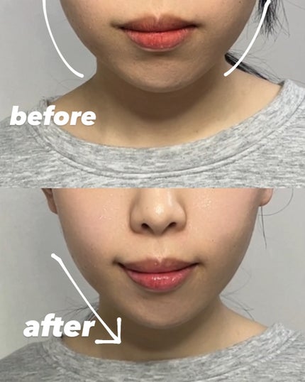 9番 NMNバイオリフトラッピングマスク/numbuzin/シートマスク・パックを使ったクチコミ(5枚目)