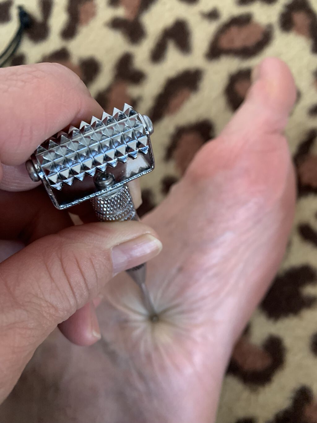 RUNONO ローラー鍼/RUNONO/ボディケア美容家電を使ったクチコミ（1枚目）