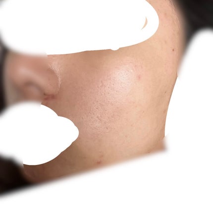 白潤プレミアム 薬用浸透美白乳液/肌ラボ/乳液を使ったクチコミ(4枚目)