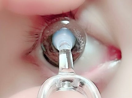 meruru メルル ソフトコンタクトつけはずし器具/meruru/その他を使ったクチコミ(8枚目)