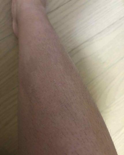 努力して変わりたい女の子 on LIPS 「最後の写真は汚いムダ毛が見えるので閲覧注意です、私は中学2年生..」(4枚目)