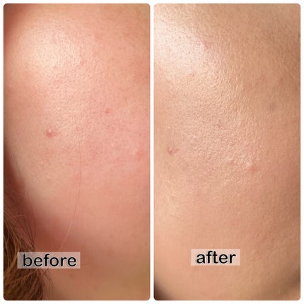 SIGNATURE ESSENCE COVER PACT /AGE20’s/クリーム・エマルジョンファンデーションを使ったクチコミ(6枚目)